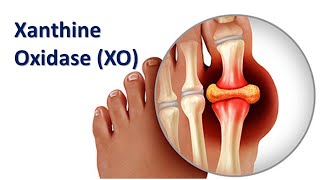 Xanthin Oxidase XO [upl. by Sillert29]