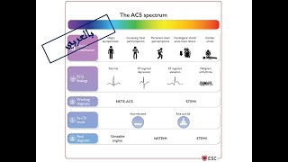 1 Diagnosis amp Triage of ACS Arabic Version [upl. by Ermey]