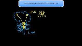 Bulbar Palsy versus Pseudobulbar Palsy [upl. by Sualakcin767]