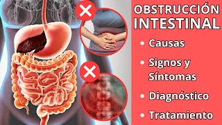 OBSTRUCCIÓN INTESTINAL  Causas signos y síntomas diagnóstico y tratamiento [upl. by Higginson]