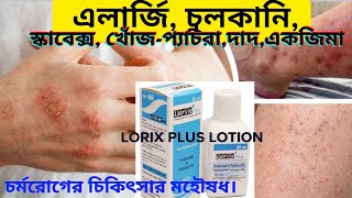 এলার্জি চুলকানি শেষ হবে এক দিনে  Lorix plus lotion Scabex [upl. by Anawak]