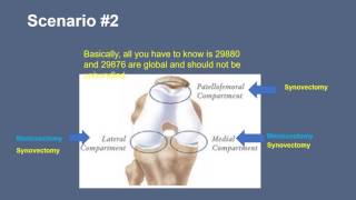 Arthroscopic Knee Coding Scenarios [upl. by Nahshon]