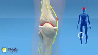 COOLIEF Genicular nerve block and radiofrequency of the Knee Joint [upl. by Schulz137]