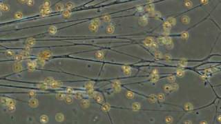 foraminiferal rhizopodia [upl. by Lorry]