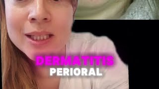 Dermatitis perioral [upl. by Rome]