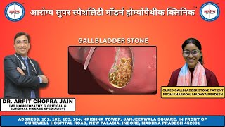 Gallbladder Stone पित्ताशय की पथरी cured by DrArpit Chopra Jain Modern Homoeopathy saved surgery [upl. by Yerggoeg]