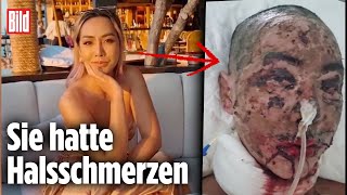 Thailändisches InfluencerModel durch Medikament entstellt [upl. by Champaigne706]