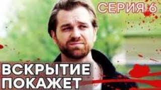 🔪 Сериал ВСКРЫТИЕ ПОКАЖЕТ  1 сезон  6 СЕРИЯ [upl. by Alel]