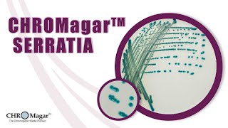 New Chromogenic Media for detection of Serratia marcescens CHROMagar Serratia [upl. by Ydwor]