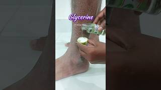 🔥Get Rid of Dry cracked Hands skincareskincaretips skincareroutine snmakeuptutoria crackedhand [upl. by Cott]