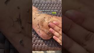 Deep Cleansing Remove Dust and Dead Skin ameenbeautytips GlowAndCleanByAmeen [upl. by Nlocnil]