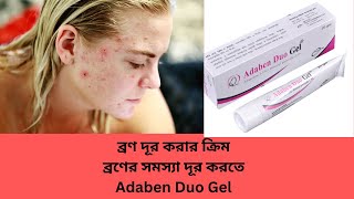 Adaben Duo Gel  Adaben Duo Gel  Review Adaben Duo Gel Bangla  ব্রণের সমস্য থেকে চিরতরে মুক্তি [upl. by Julianna77]