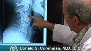 How to Read Xrays of the Cervical Spine Neck  Colorado Spine Expert [upl. by Mohorva]