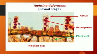 Taphrina deformans  Life Cycle By DrSmita Jain Associate Professor Botany [upl. by Shedd672]