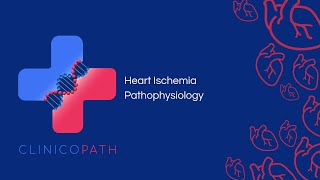 Heart Ischemia Pathophysiology [upl. by Berta]