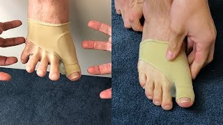 BUNION BRACE [upl. by Anastassia319]