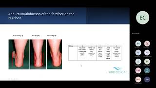 BASIC BIOMECHANICAL ASSESSMENTS [upl. by Annaes]