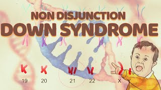 Nondisjunction Down Syndrome  Chromosome 21  Trisomy [upl. by Lesslie]