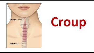 Croup [upl. by Gaal137]