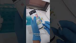 Urinanalysis part 1 Physical Examination of urine in 5 minutes [upl. by Senskell433]