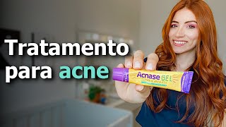 ACNASE GEL  Peróxido de Benzoíla para Cravos e Espinhas [upl. by Lukash]