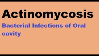 Actinomycosis  Bacterial infections of the oral cavity [upl. by Annaeirb]