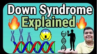 Down Syndrome explained  How it is caused [upl. by Ecertal]