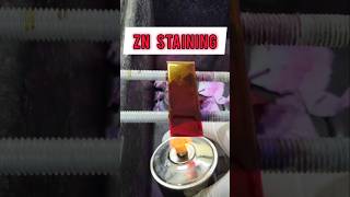 ZN Staining or Ziehl Neelsen staining shorts staining [upl. by Barsky]