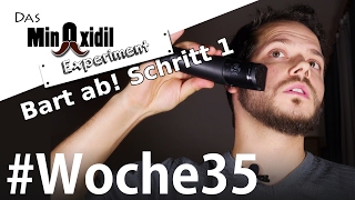 Der Bart kommt ab Stufe1  Das Minoxidil Experiment Woche35 [upl. by Rosse591]