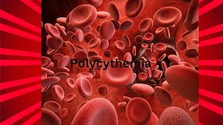 Polycythemia definition  Polycythemia rubra veratypes causes Sings and symptoms [upl. by Bradeord291]