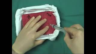 Fine needle aspiration tutorial [upl. by Longawa953]