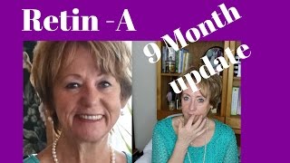 Retin A  Tretinoin 9 Month Update Before and After Pics  Monikas Beauty amp Lifestyle [upl. by Alysa228]