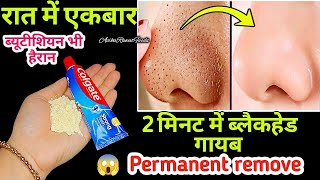 चेहरे के Blackheads Whiteheads Open Pores व दाग धब्बों से 100 छुटकारा पाएं  DIY Face ScrubMask [upl. by Aseel]