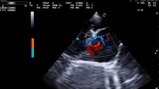 Cardiología Veterinaria  Ecocardiograma [upl. by Hareehahs]