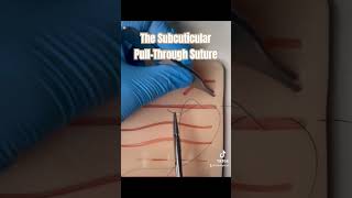 The Suture all adults and children love suture nursepractioner doctor sutures medicalschool [upl. by Ledua932]