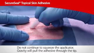 SecureSeal® Topical Skin Adhesive  Cardinal Health [upl. by Airottiv]