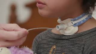 Open Suctioning with a Tracheostomy Tube at Home [upl. by Myrt]