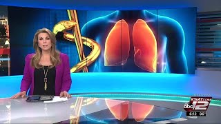 VIDEO Biologics for severe asthma [upl. by Edalb391]