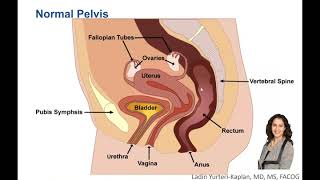 What is Uterine Prolapse and How is it Treated [upl. by Dodi]