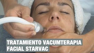 Tratamiento de vacumterapia facial con el equipo DXLight de Starvac [upl. by Uoliram417]