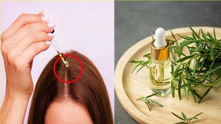 Effects Of Using Rosemary Oil For Hair Growth [upl. by Harbot]