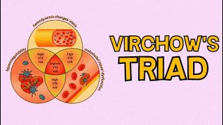 VIRCHOWS TRIAD  THE 3 KEY CAUSES OF THROMBI [upl. by Hsemar]