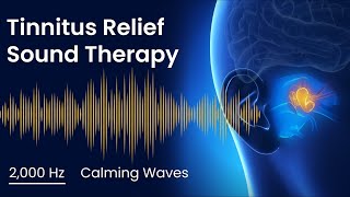 Tinnitus Sound Therapy  2000 Hz Calming Waves  2 Hours  Sound Masking for Ringing in Ears [upl. by Aelaza]