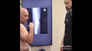 ELBOW PAIN while HAMMER CURLS elbow [upl. by Deerc]