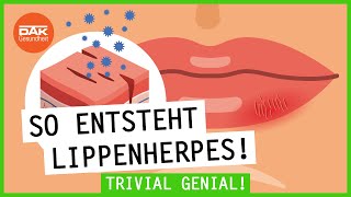 Wie entsteht Herpes  trivialgenial  DAKGesundheit [upl. by Chaffin]