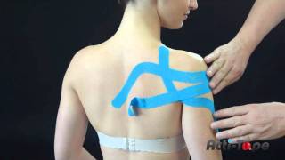 ActiTape  Frozen Shoulder [upl. by Day]