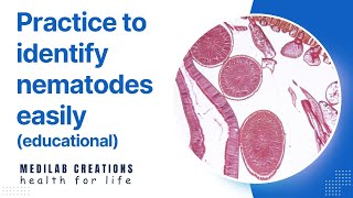 Nematodes Quiz part 1 [upl. by Gabby]