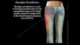 Meralgia Paresthetica  Everything You Need To Know  Dr Nabil Ebraheim [upl. by Oyr528]