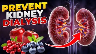 The KIDNEY DETOX Secret Doctors Dont Want You to Know [upl. by Nnylsoj]