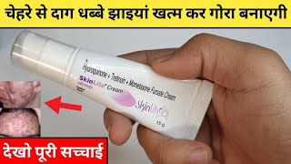 SkinLite Cream Review in Hindi  r 1 fairness cream  Skin lite Cream Use kaise karen [upl. by Hsatan884]